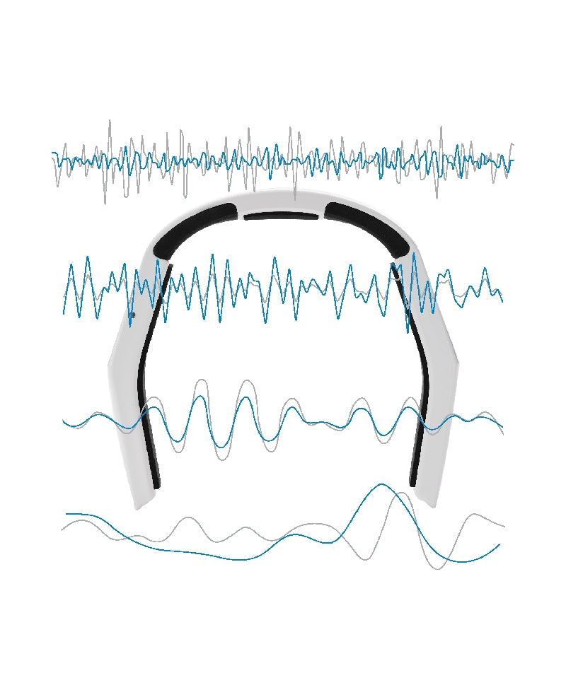 NeoRhythm rTMS