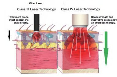 HD - CureX (Class IV laser) - Uno Vita AS