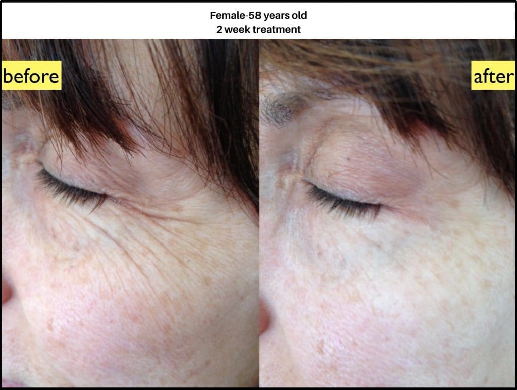 Nano Soma Natural Skin Cream - Uno Vita AS