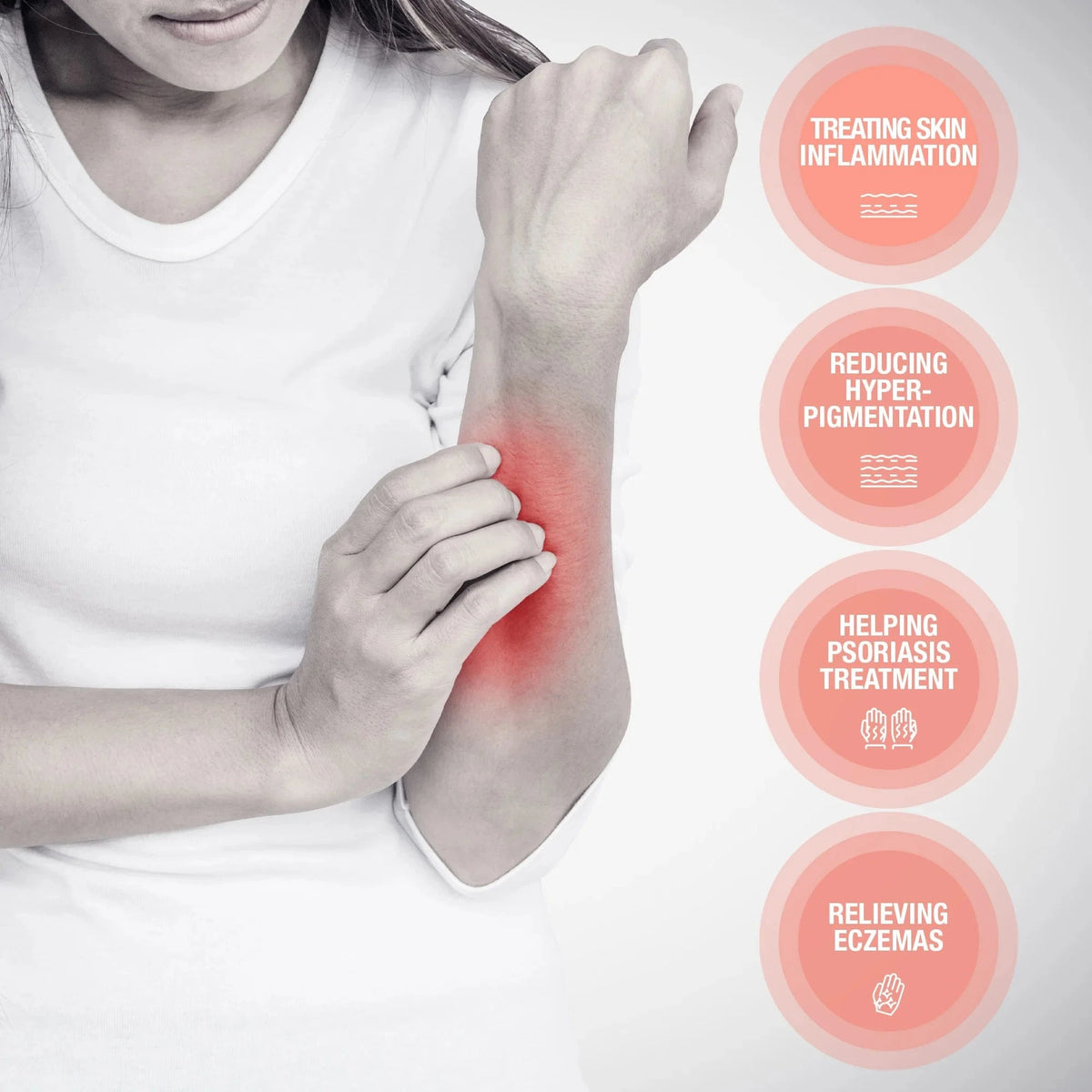 OLIVIE DERMAPSORIA - Fight Psorasis and Eczema NATURALLY! - Uno Vita AS