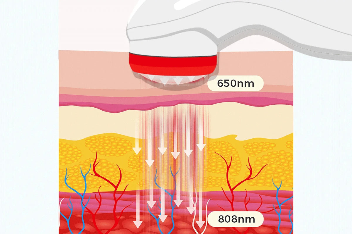 PowerCure Pro Laser – Handheld 808 nm and 650 nm Low - Level Laser for Photobiomodulation - Uno Vita AS