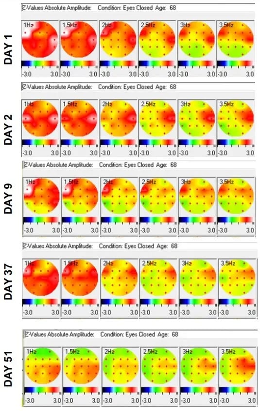 The Analemma Wand - Uno Vita AS