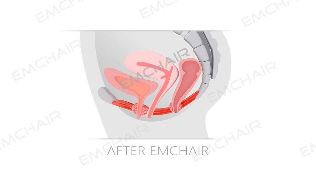 Uno Vita`s EM Chair Pro Pelvic Floor Stimulation - Uno Vita AS