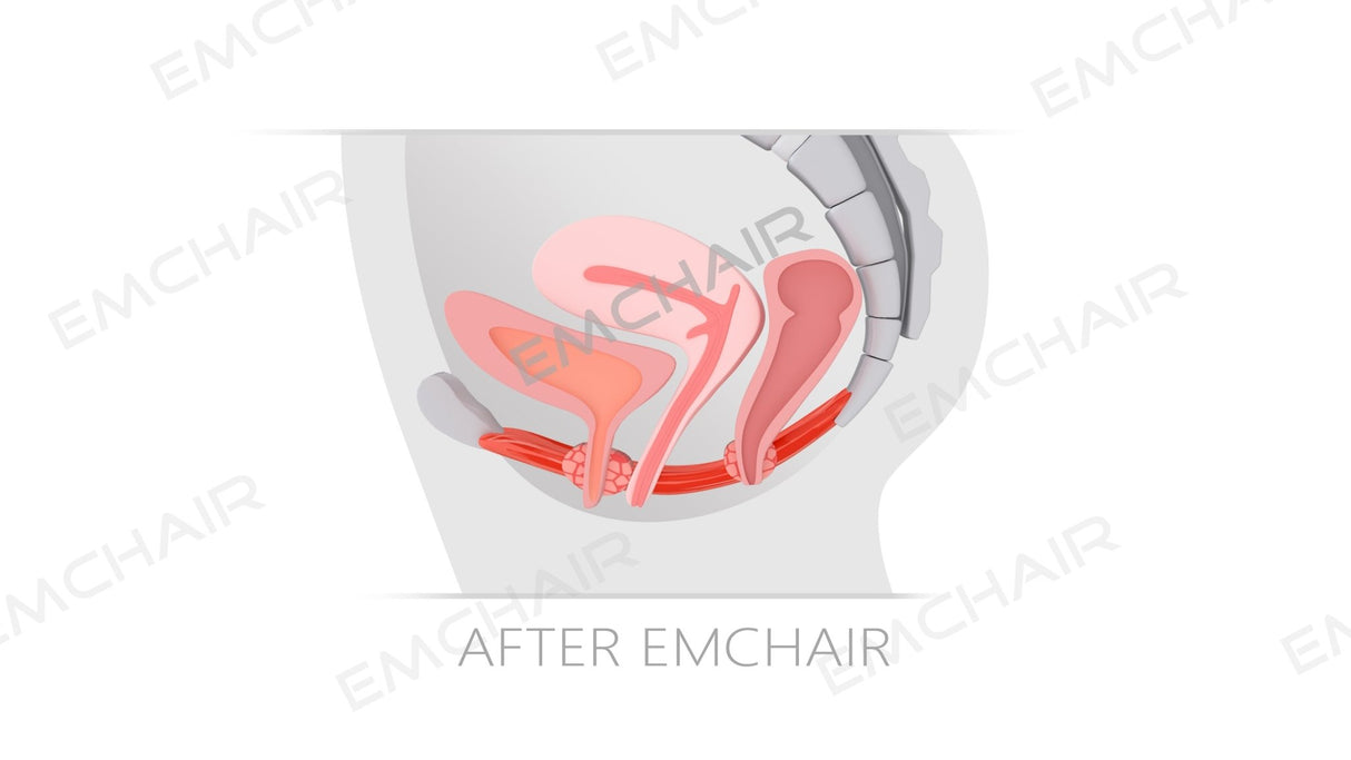 Uno Vita`s EM Chair Pro Pelvic Floor Stimulation - Uno Vita AS