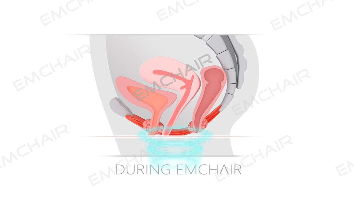 Uno Vita`s EM Chair Pro Pelvic Floor Stimulation - Uno Vita AS