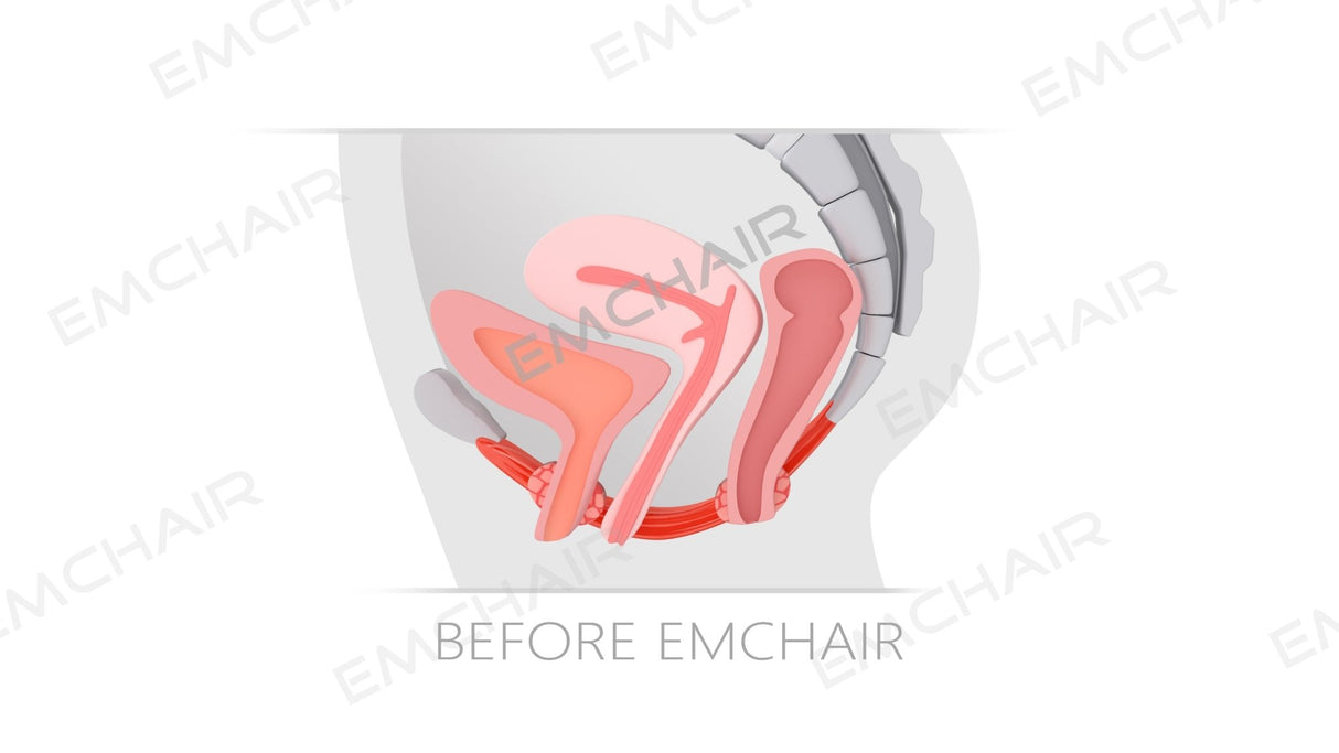 Uno Vita`s EM Chair Pro Pelvic Floor Stimulation - Uno Vita AS