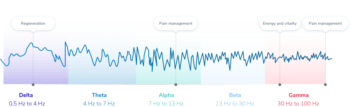 NeoRhythm rTMS
