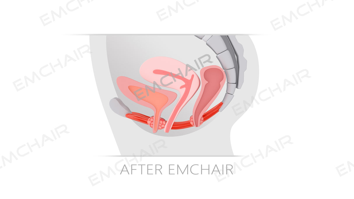 Uno Vita`s EM Chair Pro Pelvic Floor Stimulation