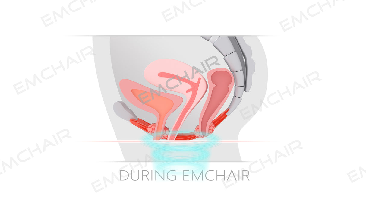 Uno Vita`s EM Chair Pro Pelvic Floor Stimulation