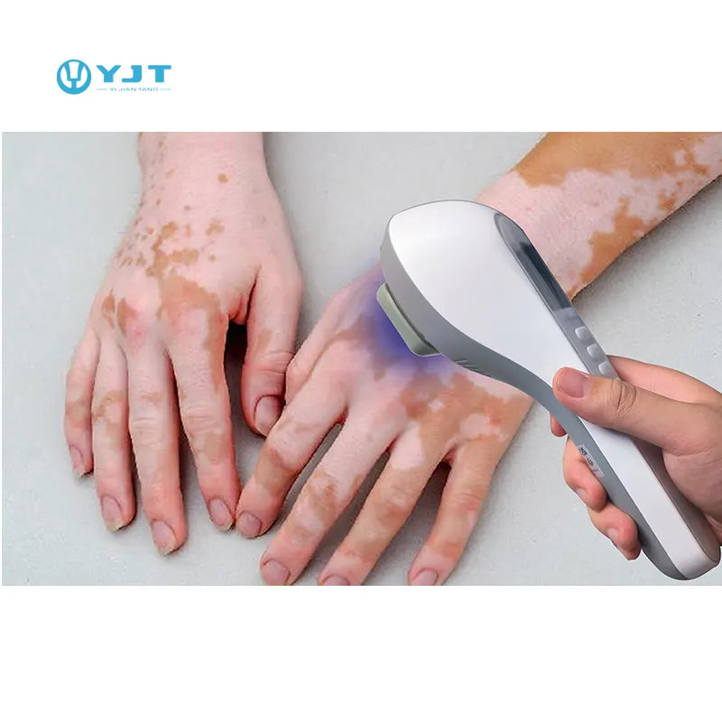 UVB Light Therapy Lamp for Skin Diseases