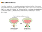 Pelvic Floor electrostimulator with biofeedback EMG