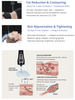CO₂ PRO – Portable CO₂ Cryotherapy for Professional Pain Management and Recovery - Uno Vita AS