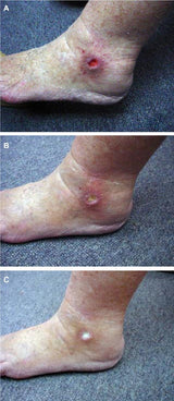 Earthing High - Silver Fitted Grounding Sheet (152x203cm) - Uno Vita AS