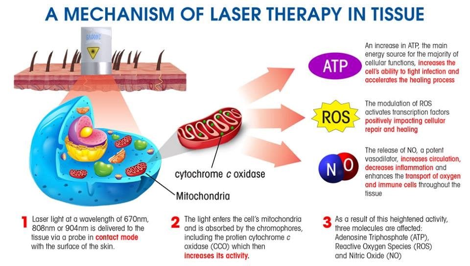 Handy Cure S pulserende laser - Uno Vita AS