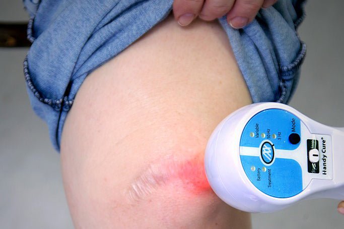 Handy Cure S pulserende laser - Uno Vita AS