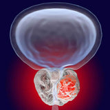 Plant Sterols – Beta - Sitosterol - Uno Vita AS