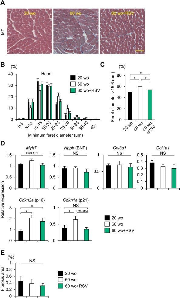 Purovitalis Liposomal Resveratrol (Date: 01.2026) - Uno Vita AS