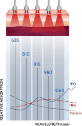 Smart Ice Class 4 Laser Therapy System (Class IV profesjonell laser terapi) - Uno Vita AS