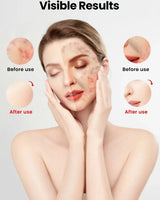 Uno Vita`s Advanced Beauty LED Light Therapy Facemask TLM200 - K 510 - Uno Vita AS