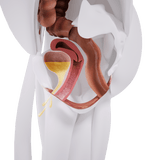 Uno Vita`s EM Chair Mini Pelvic Floor Stimulation - Uno Vita AS