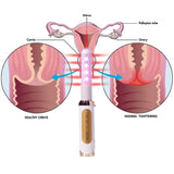 Uno Vita's rejuvenating vaginal laser - Uno Vita AS